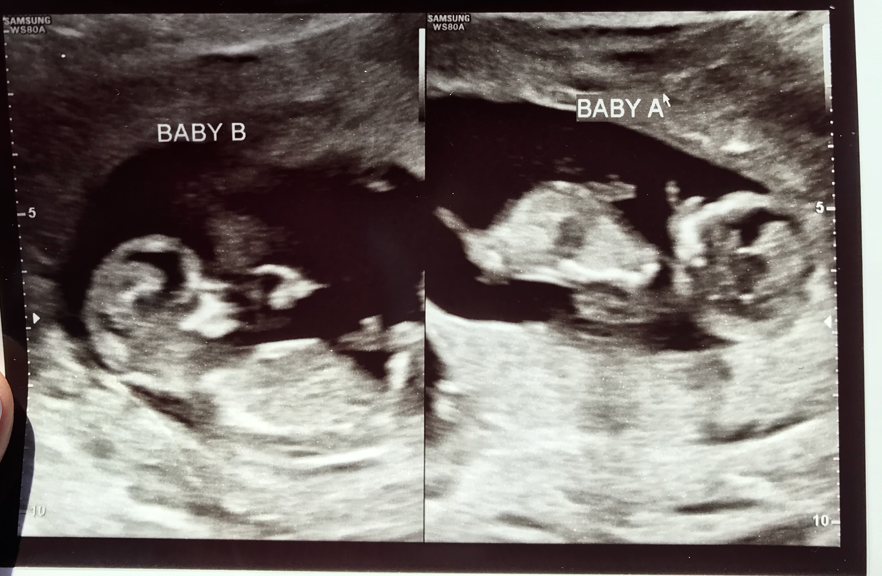Our Twins at Week 12